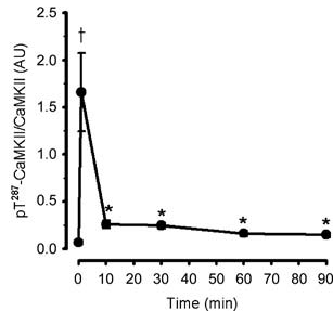 Effect of exercise duration on skeletal muscle Ca2+–calmodulin-dependent protein kinase II phosphorylation