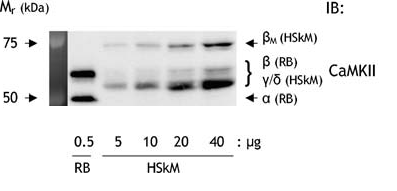 Ca2+–calmodulindependent kinase isoforms in human skeletal muscle