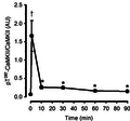 CaMKII, Rose 2006, Effect of exercise duration on skeletal muscle Ca2+–calmodulin-dependent protein kinase II phosphorylation.png