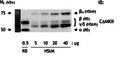 CaMKII, Rose 2006, Ca2+–calmodulindependent kinase isoforms in human skeletal muscle.png